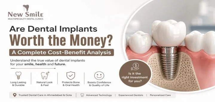 Are Dental Implants Worth the Money? Cost-Benefit Analysis | Dentist in Ahmedabad