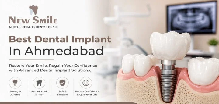 Best Dental Implant in Ahmedabad | Cost & Procedure Guide