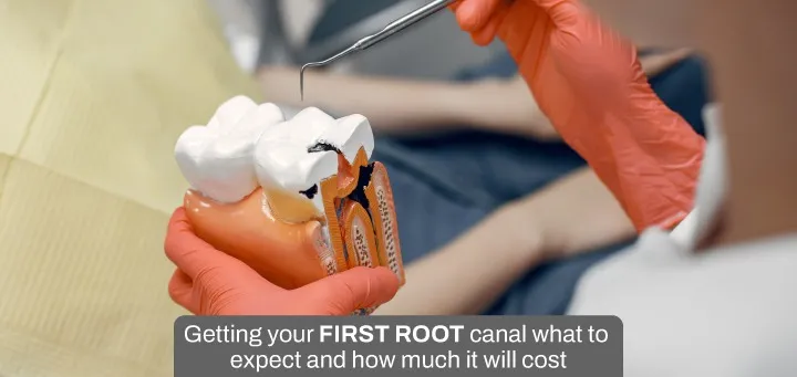 Root Canal Treatment | New Smile Multi Speciality Dental Clinic