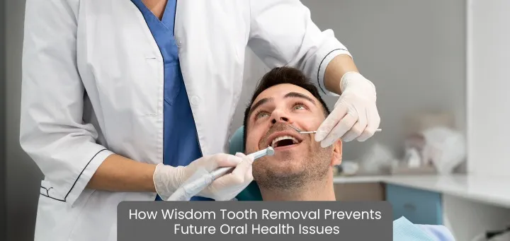 How Wisdom Tooth Removal Protects Your Long-Term Oral Health