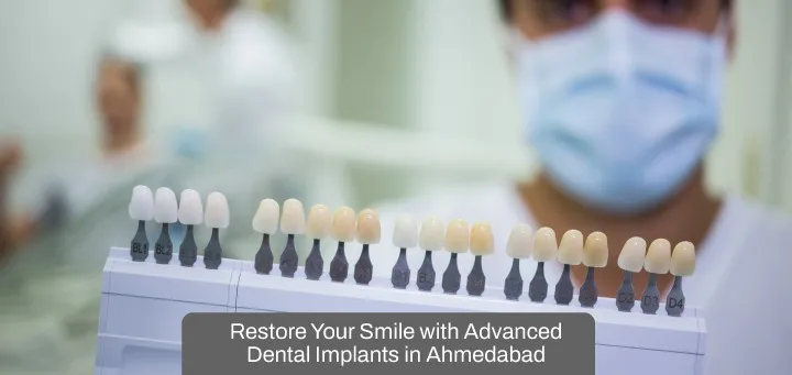 Restore Your Smile with Advanced Dental Implants in Ahmedabad