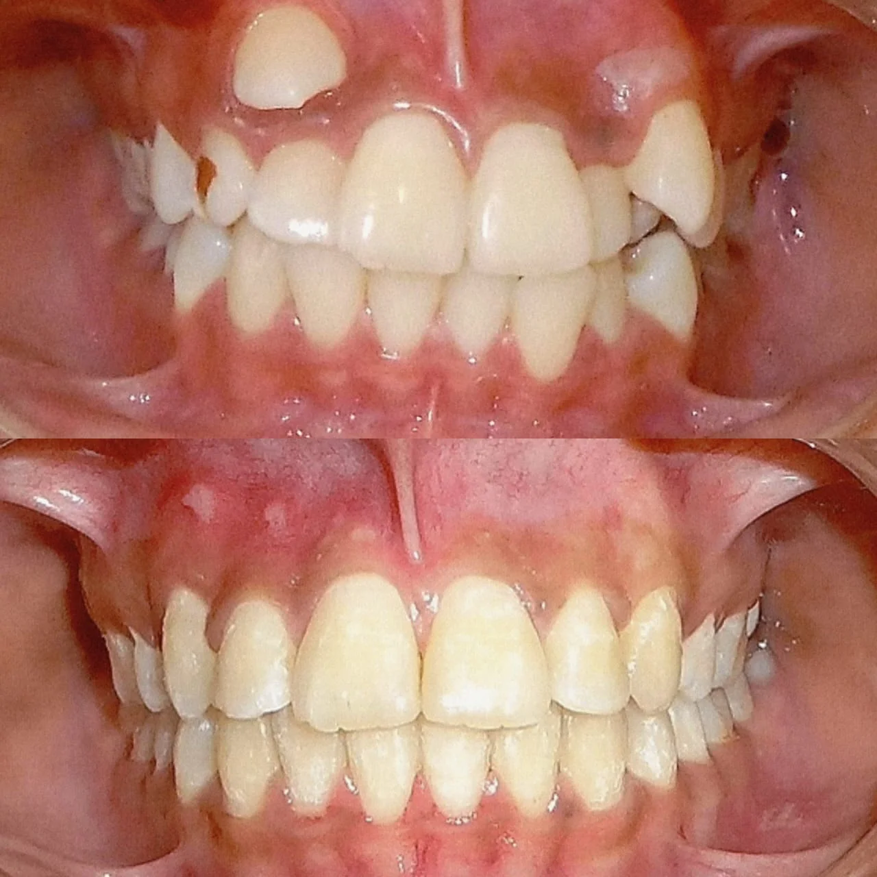 Laser Surgery at New Smile Multi Speciality Dental Clinic