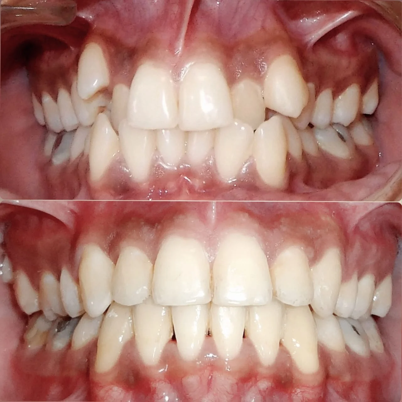 Oral Prophylaxis at New Smile Multi Speciality Dental Clinic